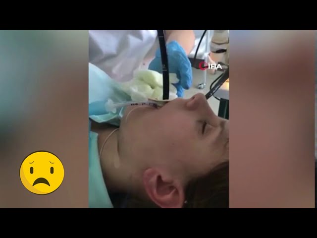 Ağacın altında uyuyan kadının ağzından giren yılan ameliyatla çıkarıldı